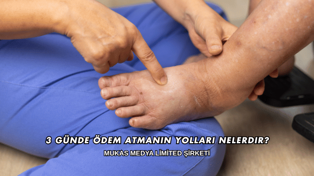 3 Günde Ödem Atmanın Yolları Nelerdir?